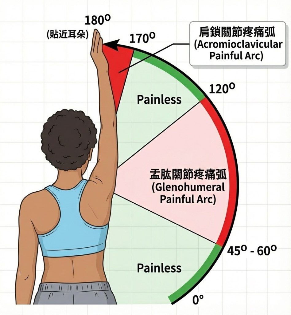 疼痛弧、painful arc